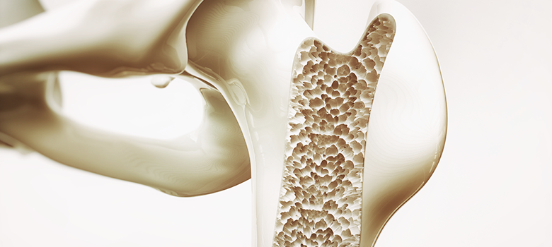 Researcher studies osteoporotic bone fractures to rethink treatment - UTSA Today