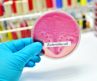 UTSA professor’s study describes new strategies for investigating microbial outbreaks