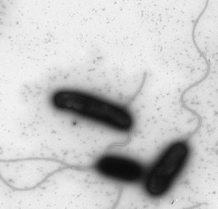 bacterium Vibro cholerae