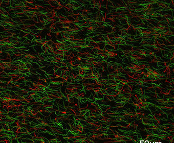 UTSA professor looks for new ways to stop the spread of Lyme disease